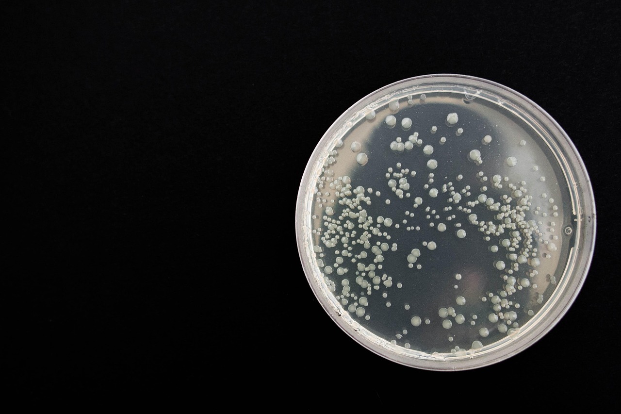 https://madyna.be/storage/activity_photos/685e68d4ee90c/bacteria-359956_1280.jpg